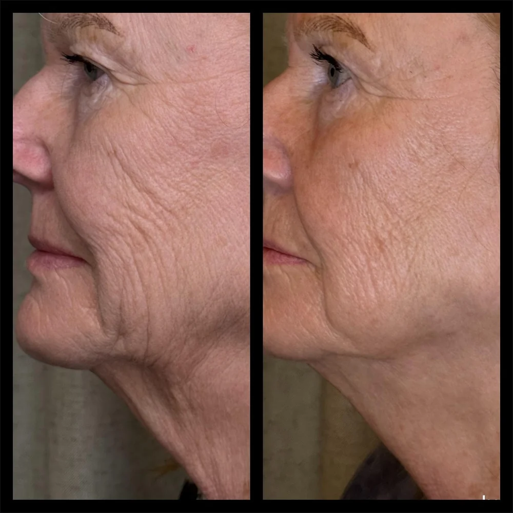 Skin Games competition case image showing visible cosmetic skin improvement